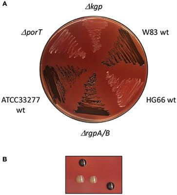 The Type IX Secretion System (T9SS): Highlights and Recent Insights into Its Structure and Function